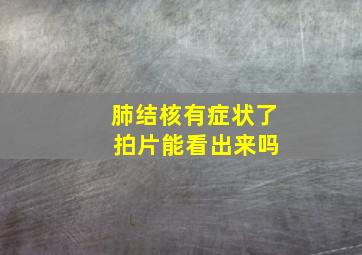 肺结核有症状了 拍片能看出来吗